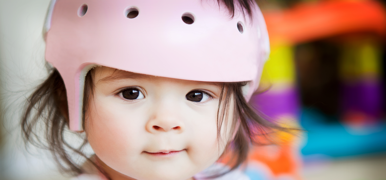 Hеlmеt Therapy fоr Flаthеаd 